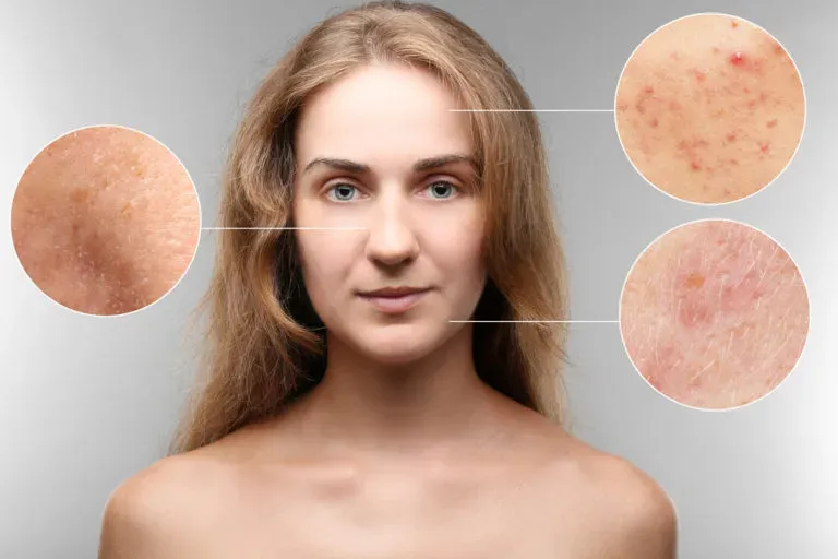How to Fix Common Skin Problems in 2025
